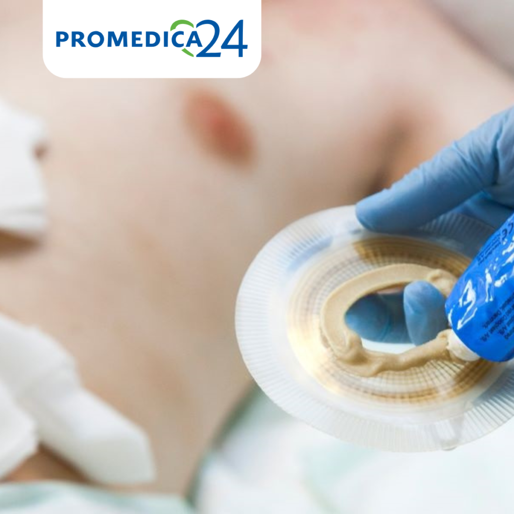Stoma Versorgung im Alter